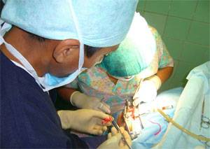 operacion-labio-leporino