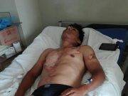 SAYAN: Mujer quemó con agua caliente a su ex esposo, causándole quemaduras de 2 grado