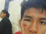 Huacho: Joven universitario es golpeado brutalmente en la universidad