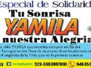 “Se necesita más apoyo y lograr curar a niña Yamilita”