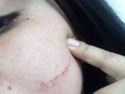 Mujer es agredida por un ‘orate’ en las puertas de su negocio en Huacho.