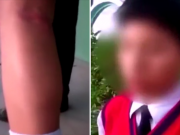 AREQUIPA: Detienen a docente que agarró a palazos a escolares que no hicieron la tarea