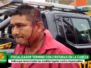 ¡Terrible! Fiscalizador terminó con múltiples fracturas en la cabeza y es respaldado por la Gerenta de la MPH