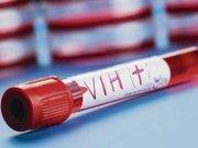 Se incrementa el numero de pacientes con VIH en Arequipa