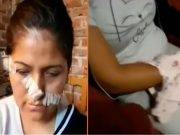 Barranca: Vecinas desfiguran rostro de mujer y le cortan el brazo