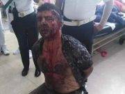 Venezolano degolló a su ex conviviente en plena vía pública.