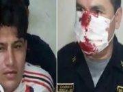 Sujeto que agredió brutalmente a policía se excusa: “Yo me había olvidado de la cuarentena”