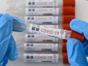 En la provincia de Huaral 35 fallecidos y 350 casos confirmados de Coronavirus