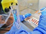 Sabe usted: ¿En qué se diferencian las pruebas rápidas y moleculares?