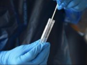 Chile: Autoridades detectan primer caso de la CEPA británica