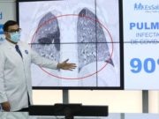 EsSalud: En solo cuatro días el covid-19 puede dañar los pulmones