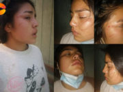 Végueta: Joven denunció que su tía la agredió con consentimiento de su padre
