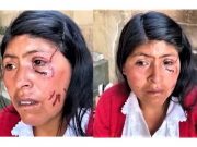 Mujer fue agredida por el padre de su hija por pedirle dinero para sus útiles escolares