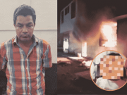 Víctima del «Monstruo Chiclayo» se recupera favorablemente tras cirugía reconstructiva