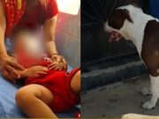 Hualmay: menor de 2 años que fue atacada por pitbull fue sometida a intervención quirúrgica