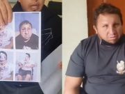 Cuidadano que terminó desfigurado tras sufrir accidente de tránsito en mototaxi pide justicia