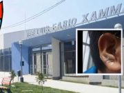 Huacho: escolar casi pierde la oreja tras presunta agresión de sus compañeros en su salón