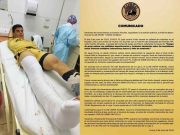 Cusco F.C. en comunicado criticó a Unión Huaral y se quejó por el mal estado del estadio Huaralino