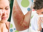 Día Mundial de la alergia: Conoce AQUÍ los tipos más comunes de alergia