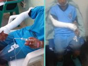 Huacho: escolar se fracturó el brazo y tuvo que esperar 8 horas para ser atendido en EsSalud