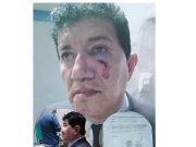 Huacho: Pasajero fue agredido por chofer de colectivo tras no estar de acuerdo con tarifa
