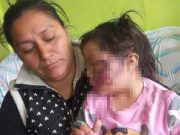 Huaura: niña de 2 años fue ferozmente atacada por perro callejero y terminó desfigurada