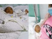Huaral: Madre de familia pide ayuda para su bebé de tan solo un mes de nacido con infección generalizada