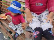 Huacho: bebé de 2 años con malformación en pies y manos necesita ayuda para tratamiento