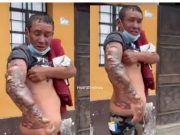 Chancay: Hombre que ayudó en incendio fue dado de alta y tiene quemaduras de segundo grado, necesita ayuda