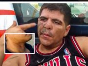 Hualmay: sujeto atacó con una tijera a chofer en el cuello para robarle su mototaxi