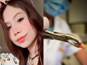 Murió joven de 20 años que terminó en UCI tras extraerse muela de juicio en clínica dental