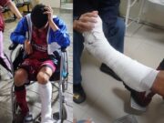 Denuncian públicamente al Club Laure Sur de Chancay por presuntamente abandonar a jugador lesionado