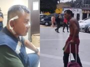 Chancay: Fiscalizador terminó herido tras enfrentamiento con sujeto que limpia autos