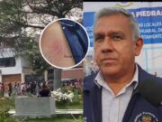 Presuntos vendedores ambulantes atacaron a pedradas al Alcalde de Huaral en su vivienda