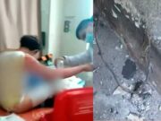 Joven terminó con graves quemaduras tras explotarle celular en sus manos