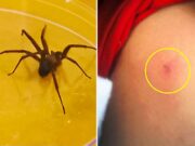 Minsa alerta aumento de riesgo de picaduras de insectos durante el verano Minsa alerta aumento de riesgo de picaduras de insectos durante el verano