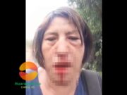 Ex Ministra de la Mujer publica brutal agresión contra una mujer en Huaral Ex Ministra de la Mujer publica brutal agresión contra una mujer en Huaral