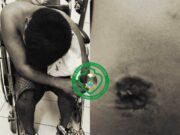 Huaral: Hombre resulta herido tras pelea en paradero. Huaral Hombre resulta herido tras pelea en paradero.