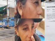 Vendedora de frutas denuncia agresión de pareja de venezolanos cerca al Cerro San Cristóbal Vendedora de frutas denuncia agresión de pareja de venezolanos cerca al Cerro San Cristóbal