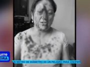 Comas: Mujer termina ensangrentada al impactarle en la cara un candado lanzado por un sereno Comas Mujer termina ensangrentada al impactarle en la cara un candado lanzado por un sereno