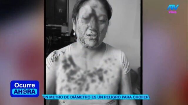 Comas Mujer termina ensangrentada al impactarle en la cara un candado lanzado por un sereno